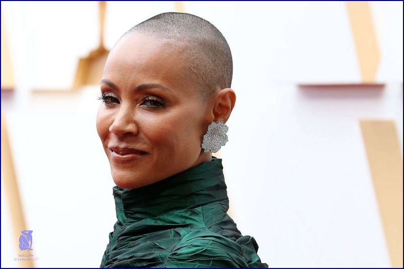Jada Pinkett Smith: Alopecie! Jada Pinkett Smith: Alopecie!