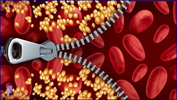 Jak Rychle Snížit Cholesterol? Jak Rychle Snížit Cholesterol?