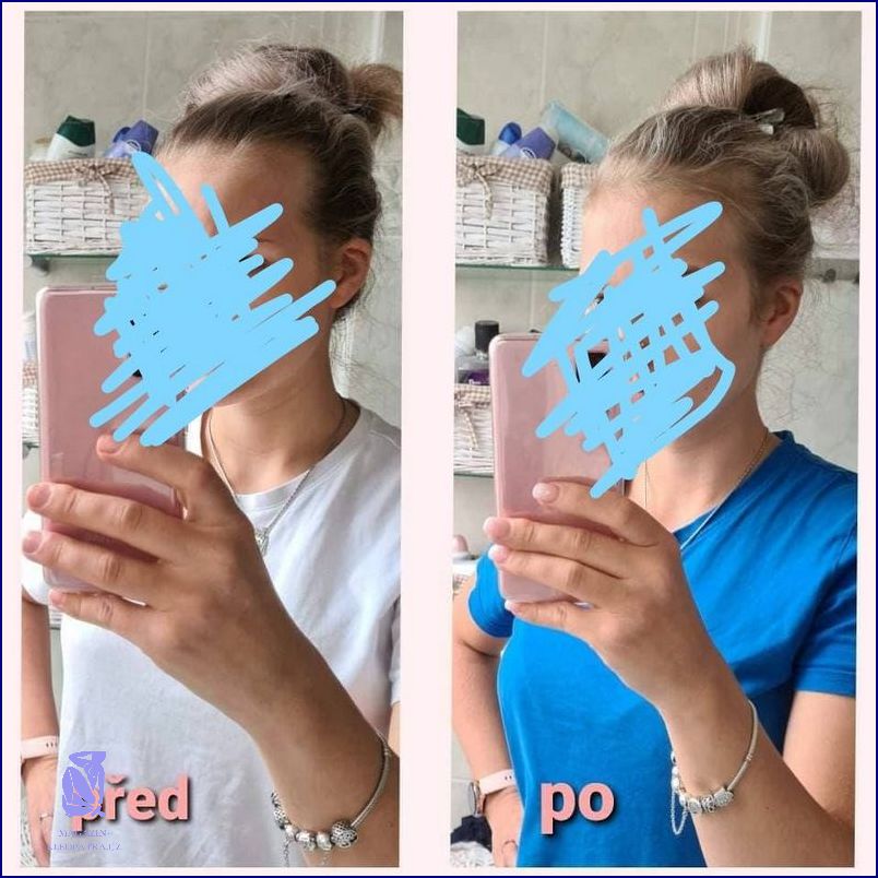 Neuvěřitelné! Padají mi VLASY!