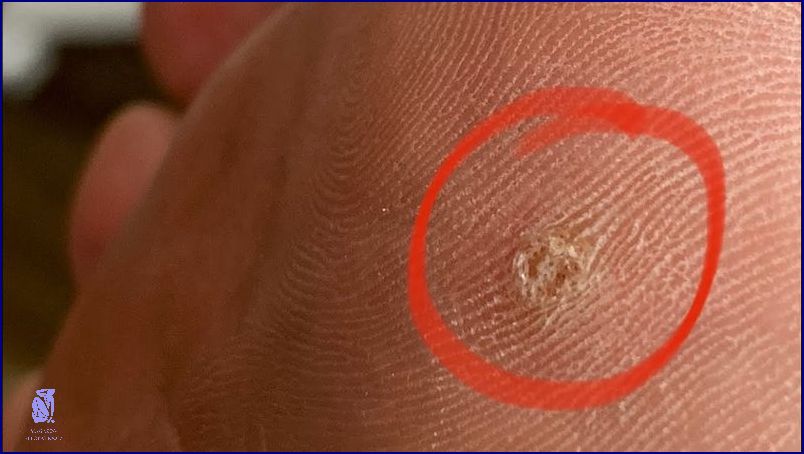 Jak Rychle Vyléčit Průdušky? Přečtěte Si!