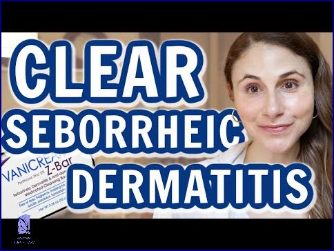 Jak Zvládnout Seboroickou Dermatitidu Ve Vlasech?