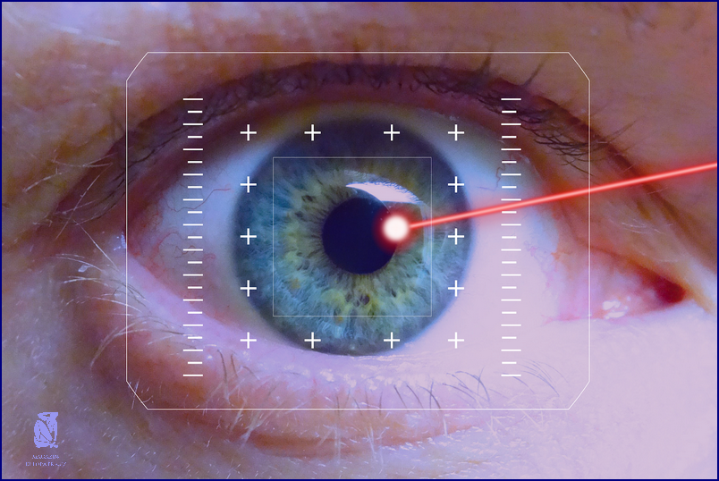Laserová Operace Očí: Zaznamenáte Okamžitou Změnu!