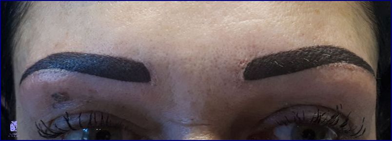 Nepovedený Permanentní Make Up? Už Víme!