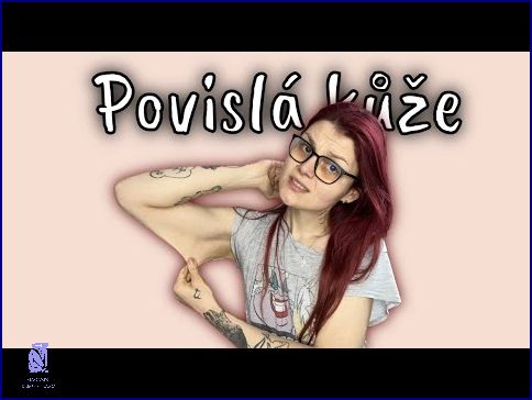 Pozor: Povislá Kůže Po Zhubnutí!