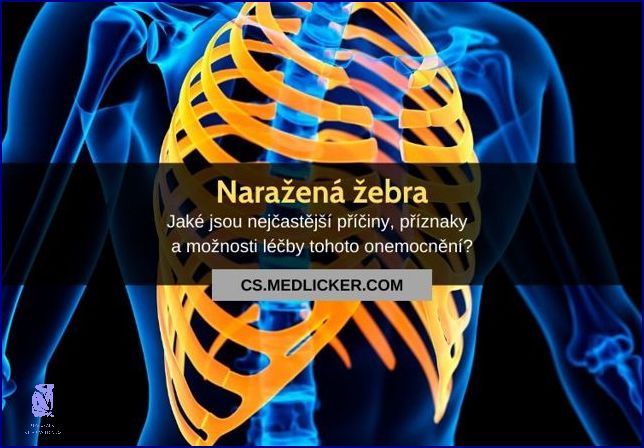 Bolest Žeber Na Dotek: Příznak čeho? Bolest Žeber Na Dotek: Příznak čeho?