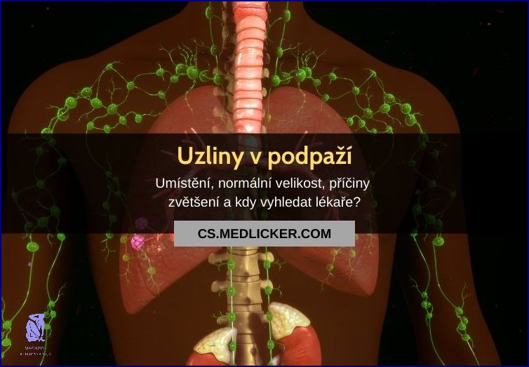 Bolestivé Uzliny V Podpaží: Jak To Řešit?