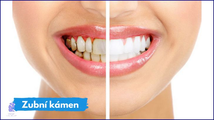 Jak Se Zbavit Ekzému? Tady Je Řešení! Jak Se Zbavit Ekzému? Tady Je Řešení!