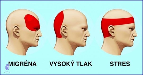 Jak Se Zbavit Úzkosti Bez Léků: 5 Tipů! Jak Se Zbavit Úzkosti Bez Léků: 5 Tipů!