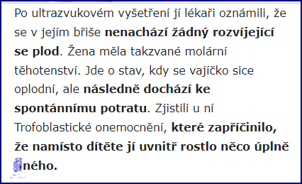 Zadky v Leginách? Neuvěříte, co se stalo!
