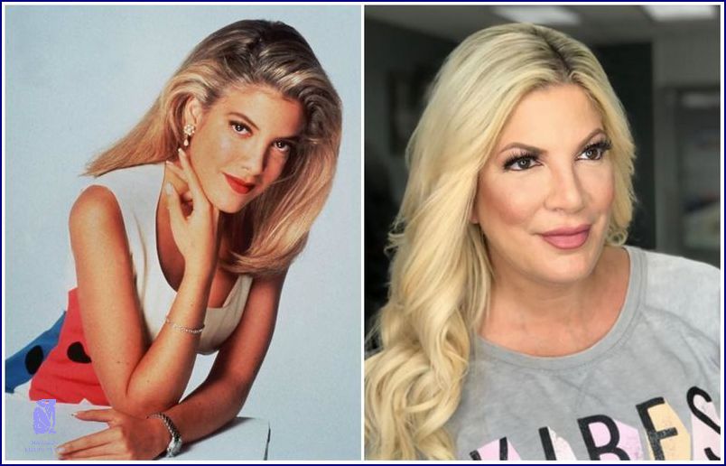 Beverly Hills 90210 Herci: Překvapivá realita! Beverly Hills 90210 Herci: Překvapivá realita!