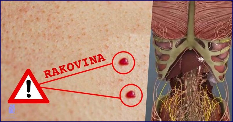 Šokující Význam Červených Teček Na Jazyku! Šokující Význam Červených Teček Na Jazyku!