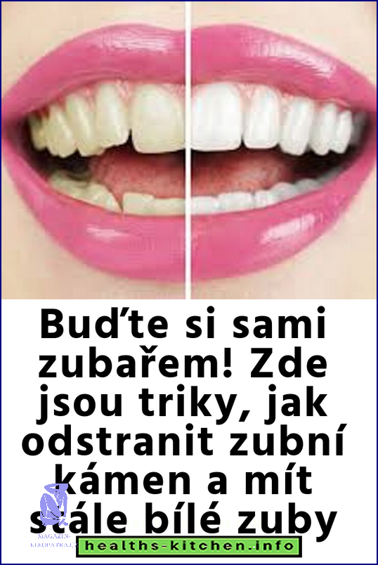 Už Víte, Jak Odstranit Kartáček Na Zubní Kámen?” Už Víte, Jak Odstranit Kartáček Na Zubní Kámen?”